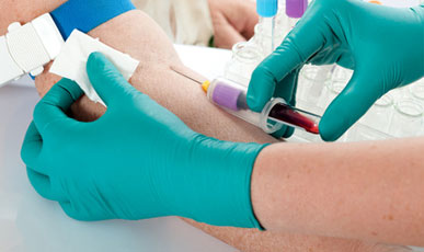 Do I Need to Fast Before Blood Tests?